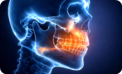Traumatologie maxillo-faciale